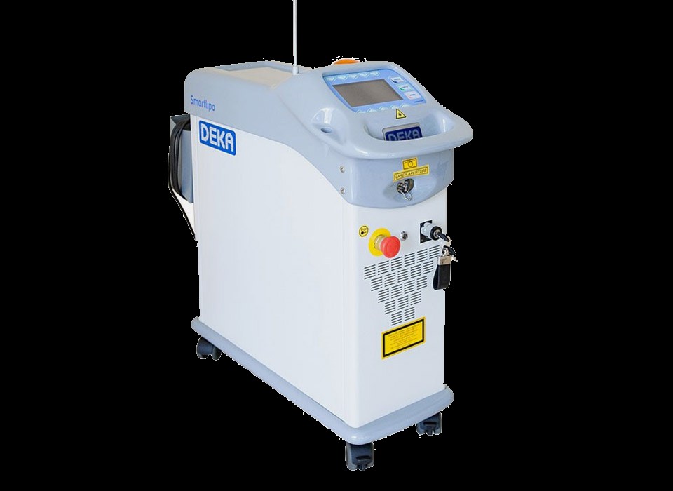 Equipo Smartlipo de DEKA para láserlipólisis
